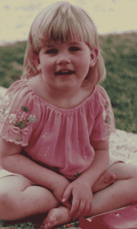 Asti Mary Eczema As A Child Topical Steroid Withdrawal Australia